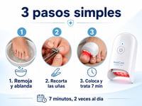 Laser Antihongos Para Uñas Con Luz Led
