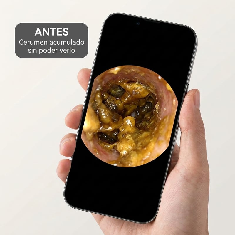 Limpiador Oidos con cámara — antes