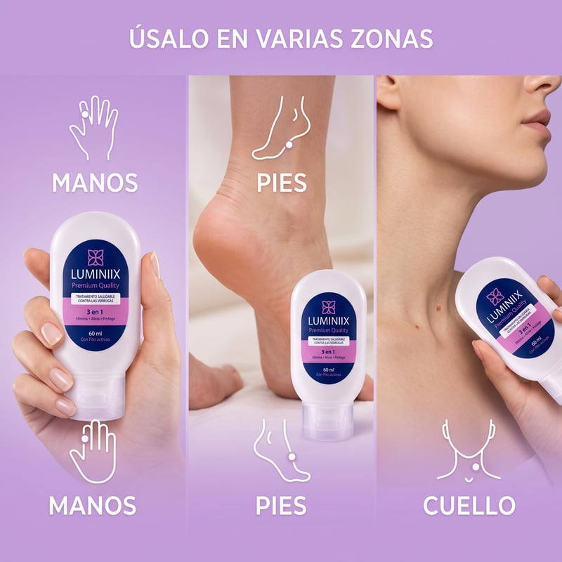 Aplicación de Luminiix 3 en 1 en manos, pies y cuello contra las verrugas