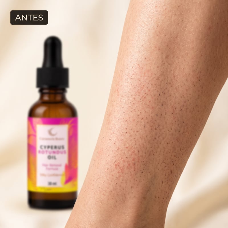 Aceite para la reducción natural del vello — antes